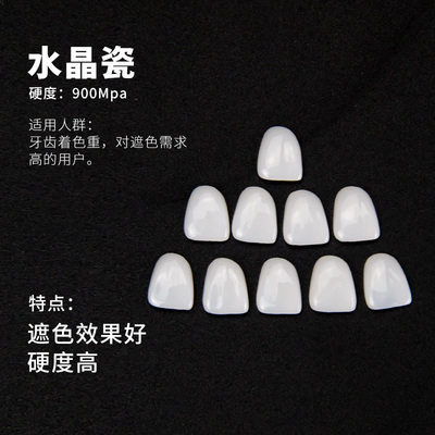 水晶瓷贴面